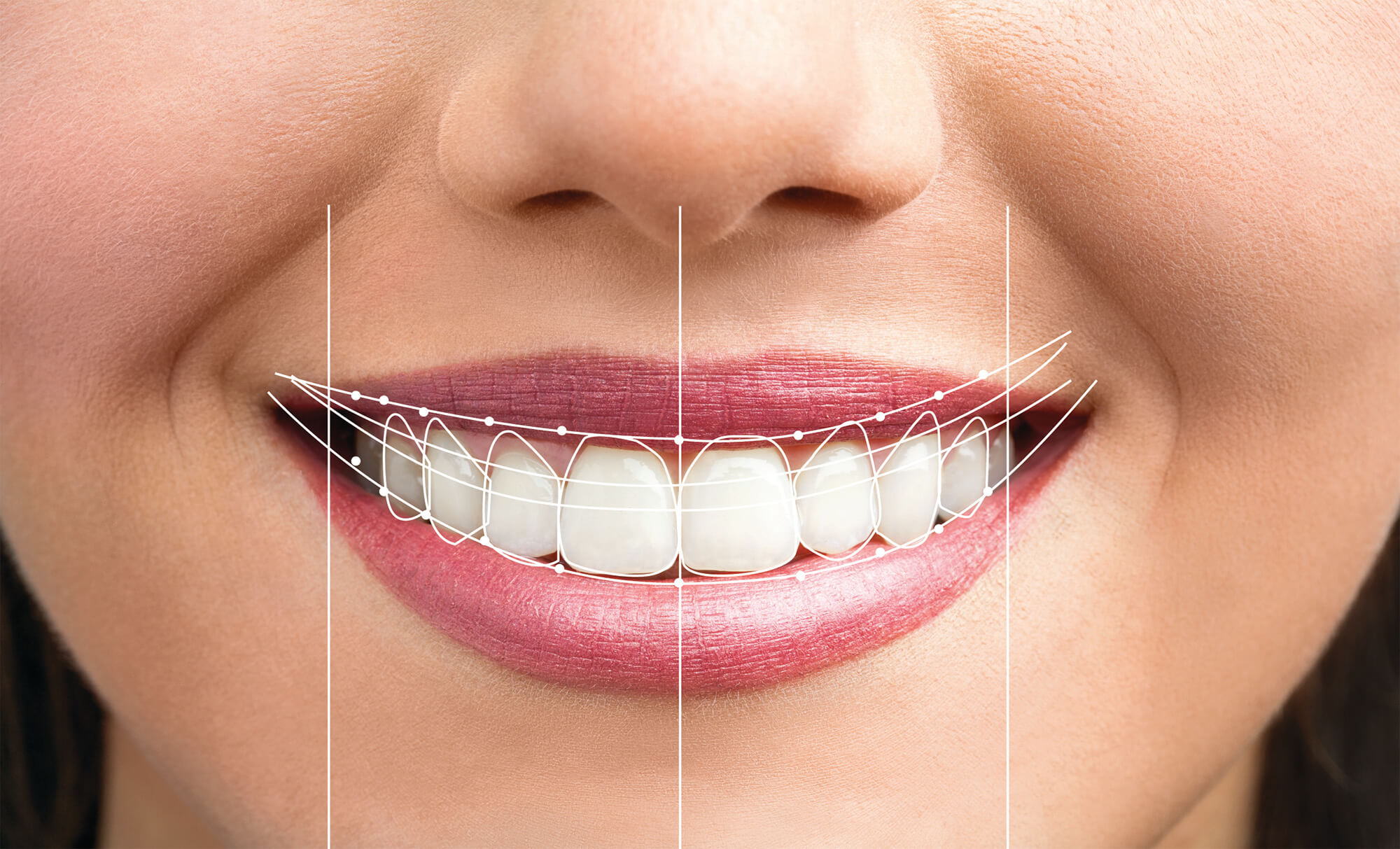 Cosmetic Dentistry