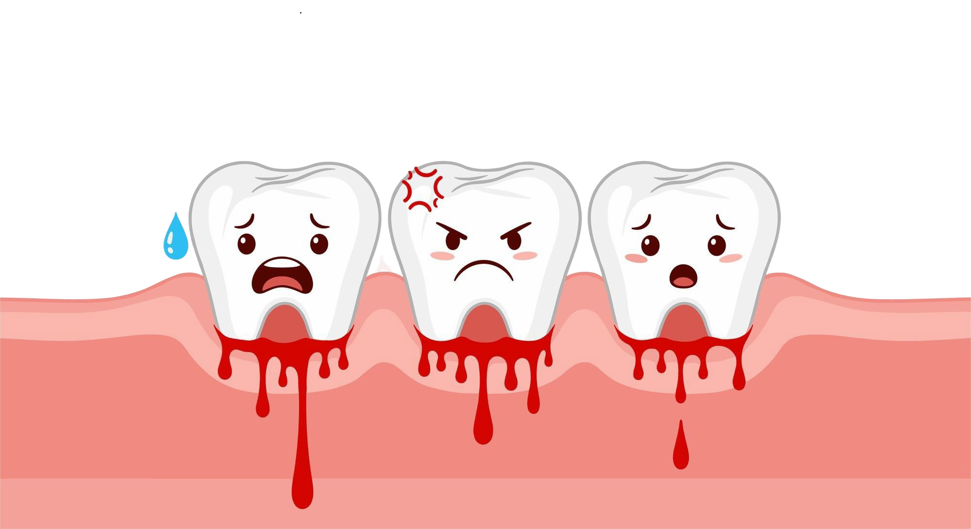 Bleeding Gums Treatment in Hanamkonda & Warangal