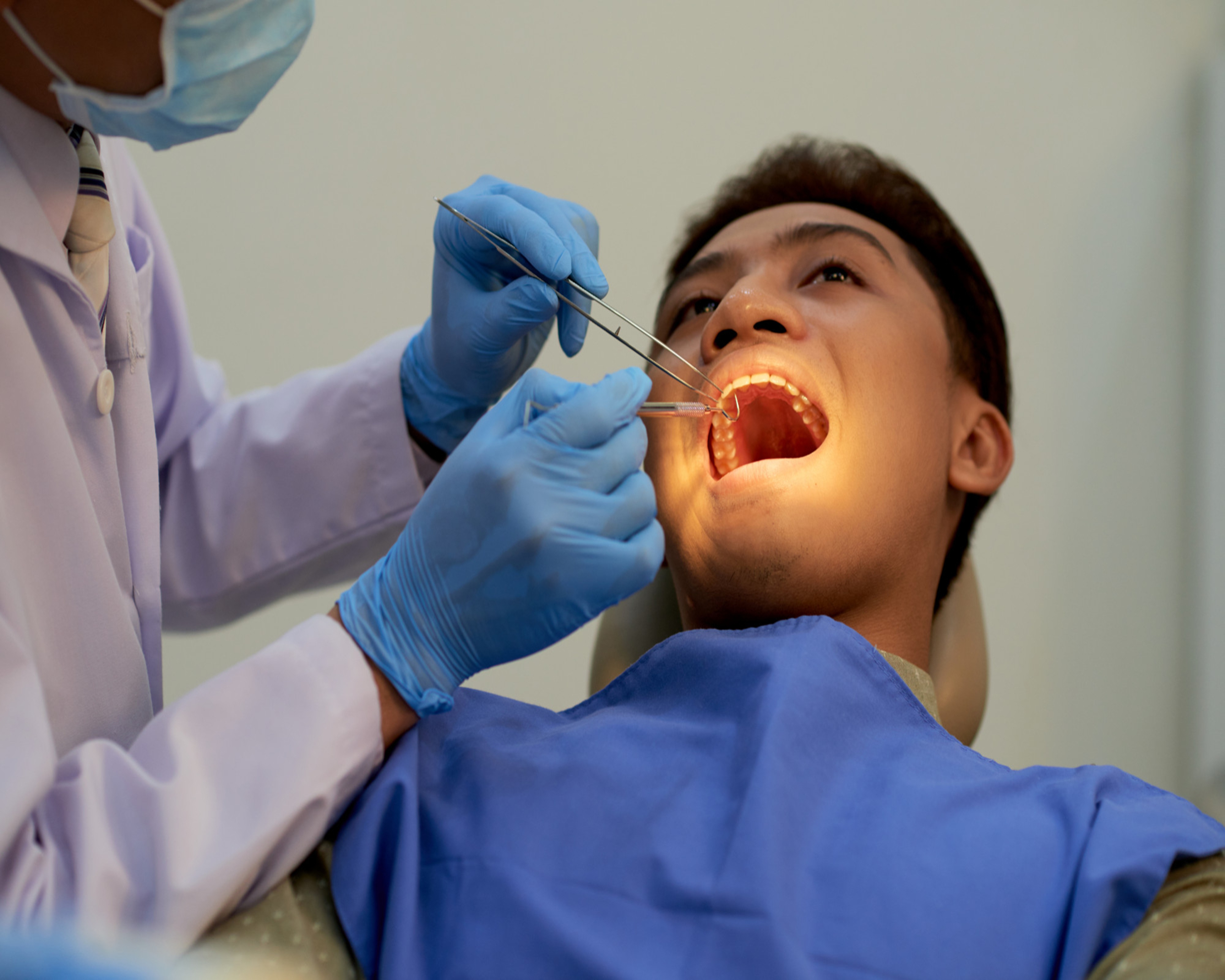 Painless Root Canal