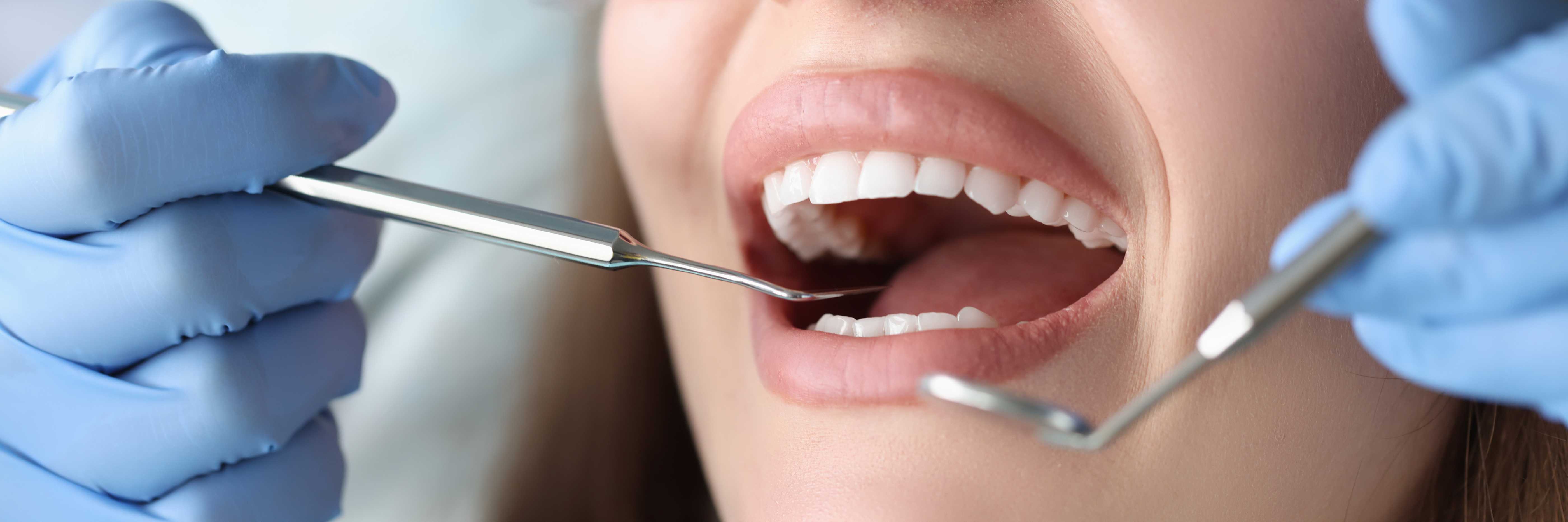 Top Reasons to Visit a Dentist in Hanamkonda Regularly for Better Oral Health