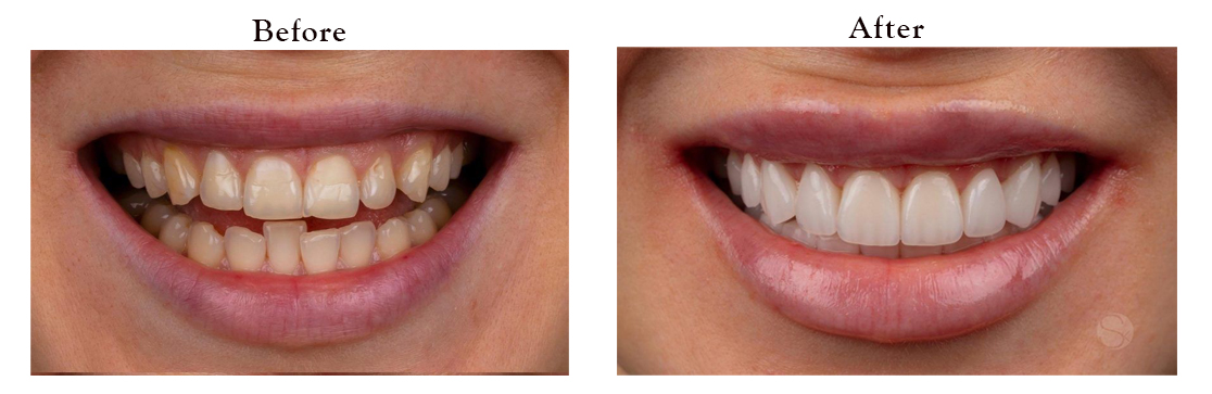Dental Transformation