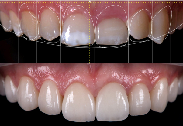 Dental Treatment Plan