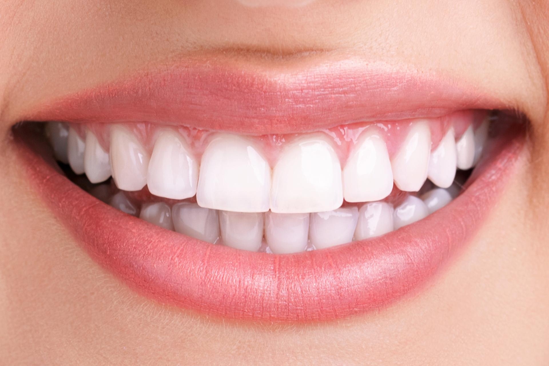 Healthy Smile