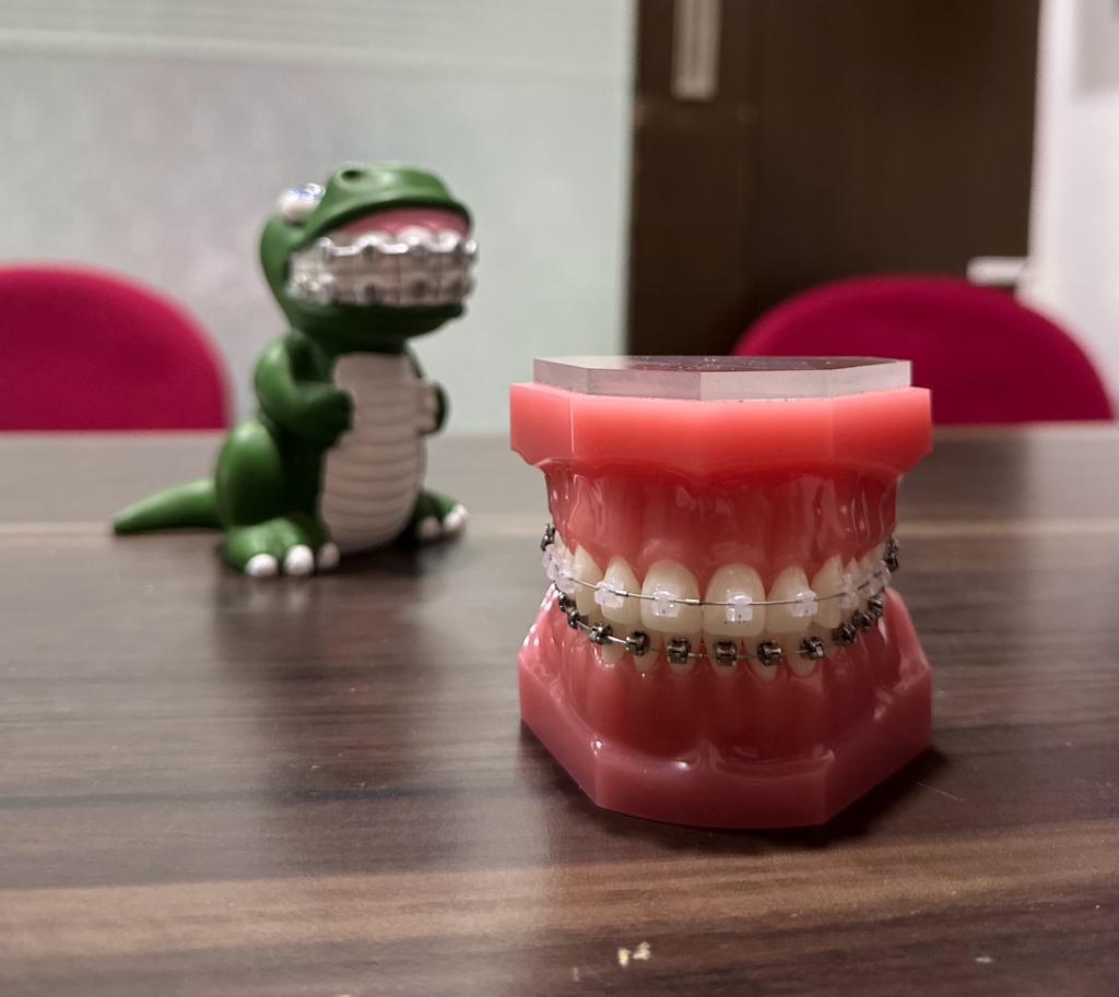 Teeth Straightening