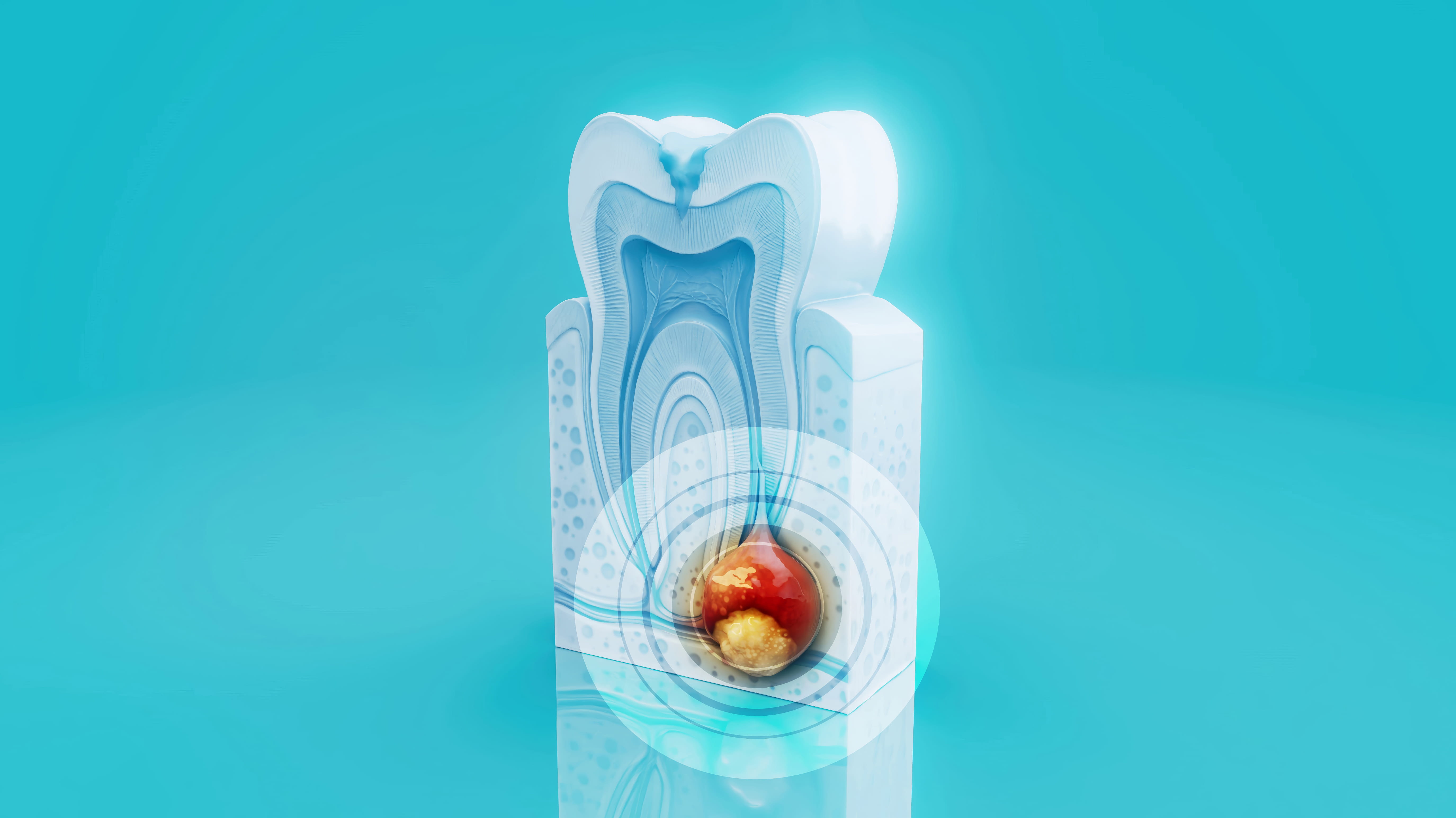 tooth pain treatment